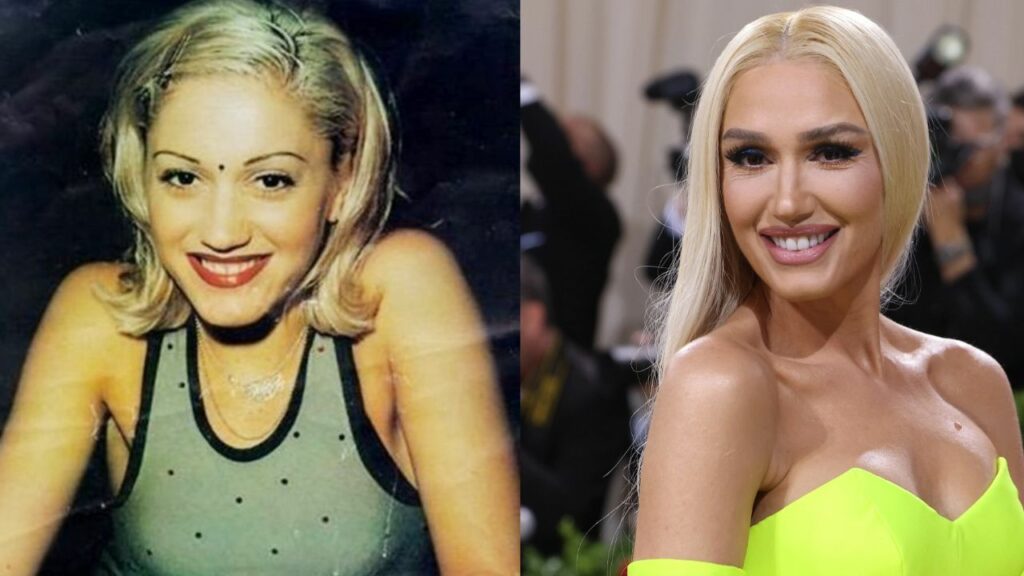 Gwen Stefani's Plastic Surgery: The Voice Judge Looks Completely Different on Late Night with Seth Meyers!