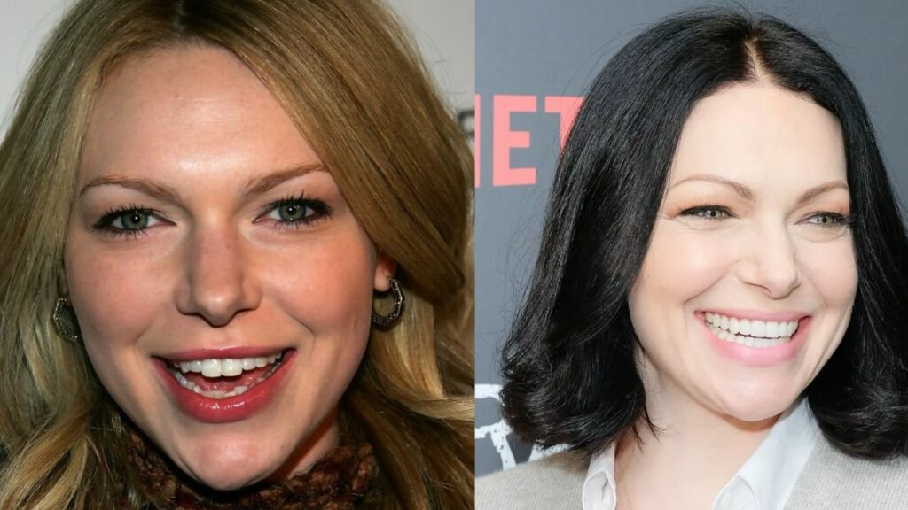 Laura Prepon’s Teeth: Comparing Her Before and After Pictures, the Donna Actress From 'That 70s Show' Seems to Have Used Veneers!