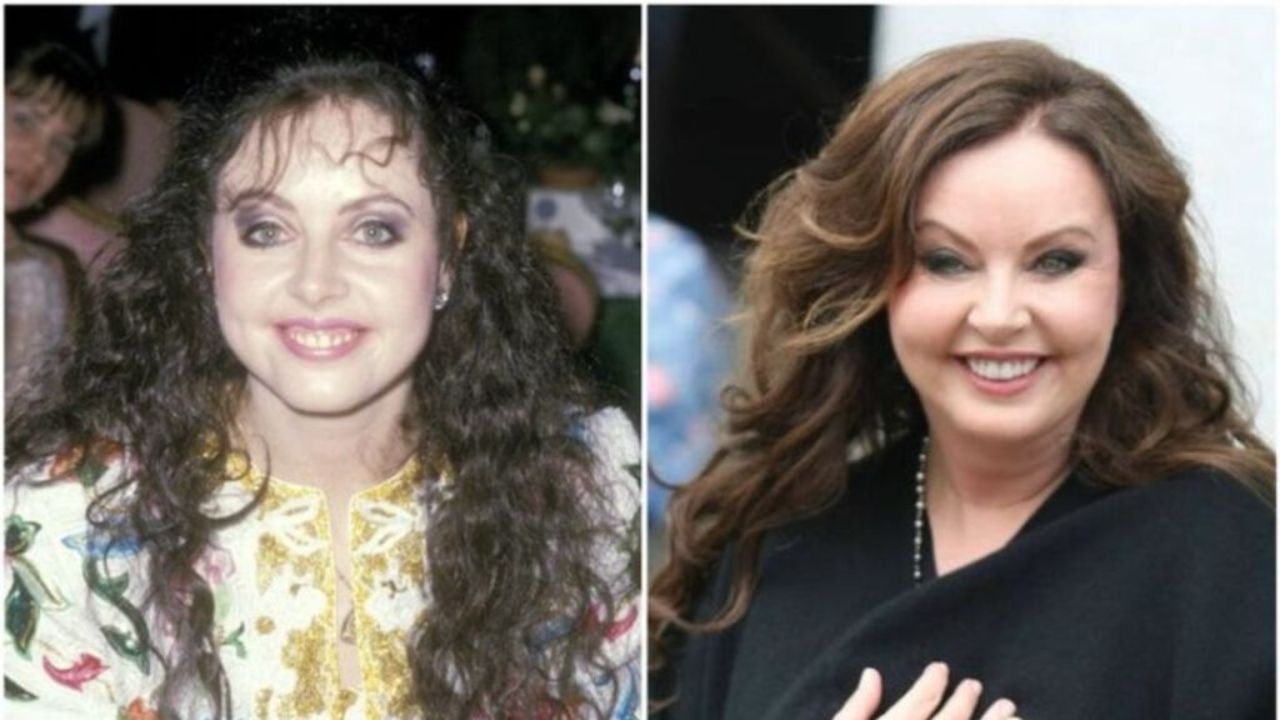 Sarah Brightman before and after plastic surgery.