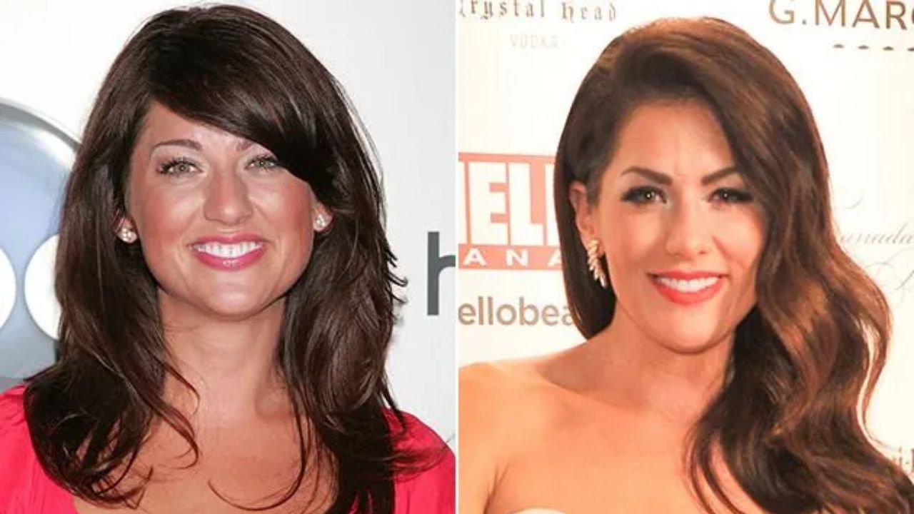 Jillian Harris before and after plastic surgery.