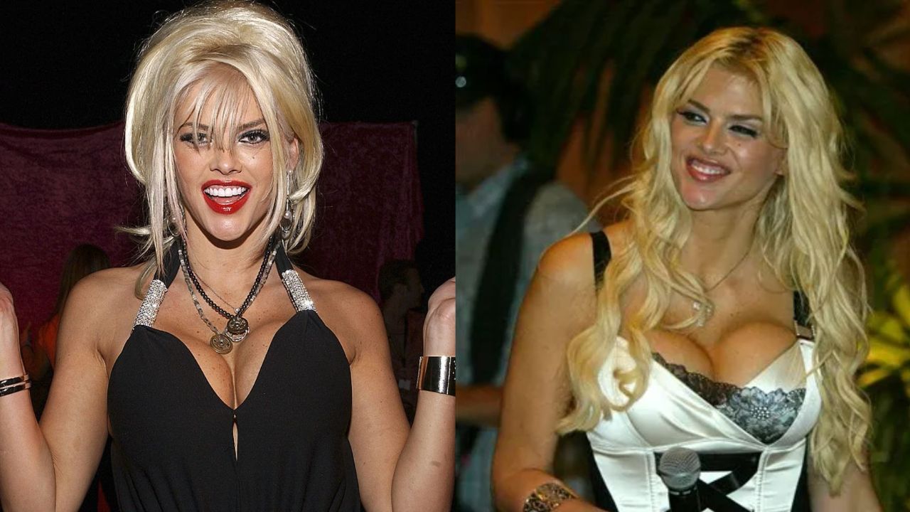 Anna Nicole Smith before and after plastic surgery.