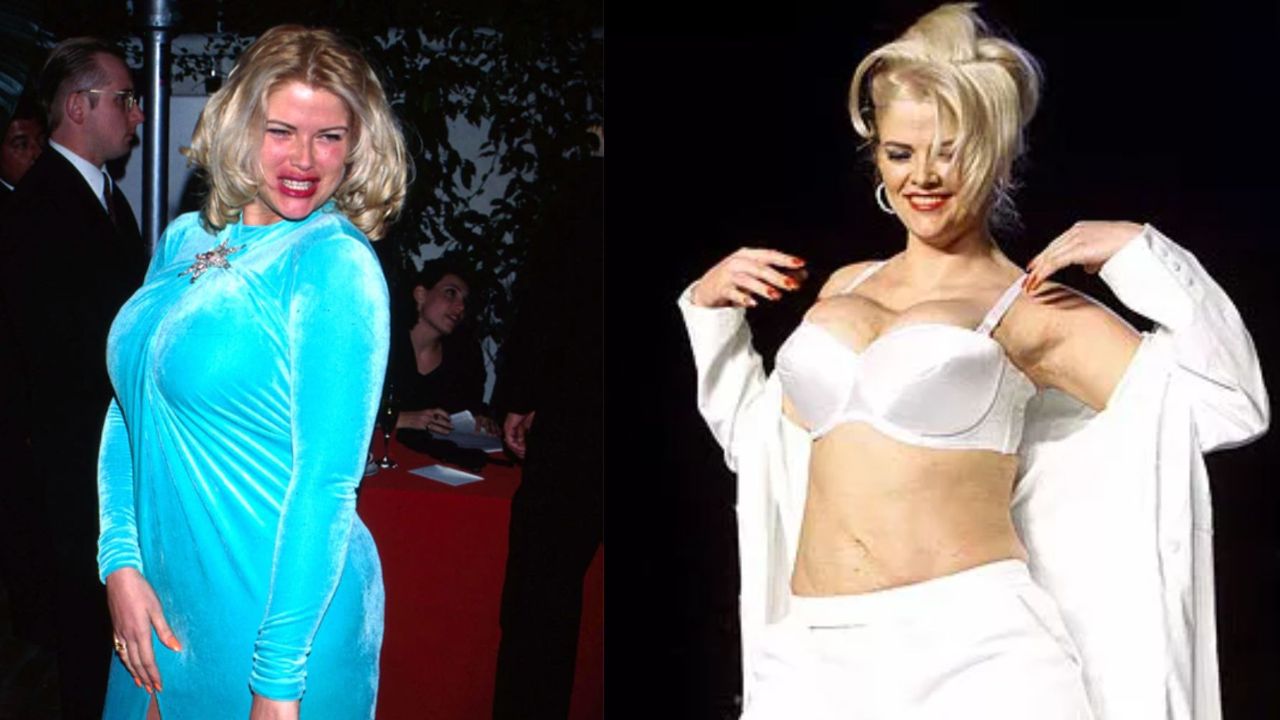 Anna Nicole Smith before and after weight loss.