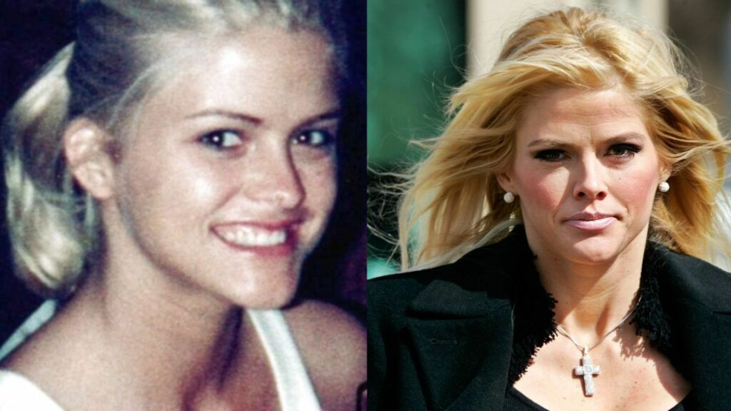 Anna Nicole Smith Before Plastic Surgery: The Untold Truth!