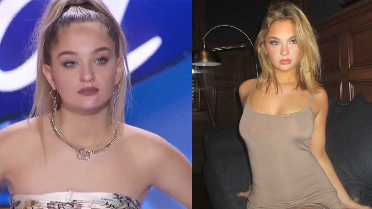 Claudia Conway’s Plastic Surgery: Before & After Pictures Examined! blurred-reality.com