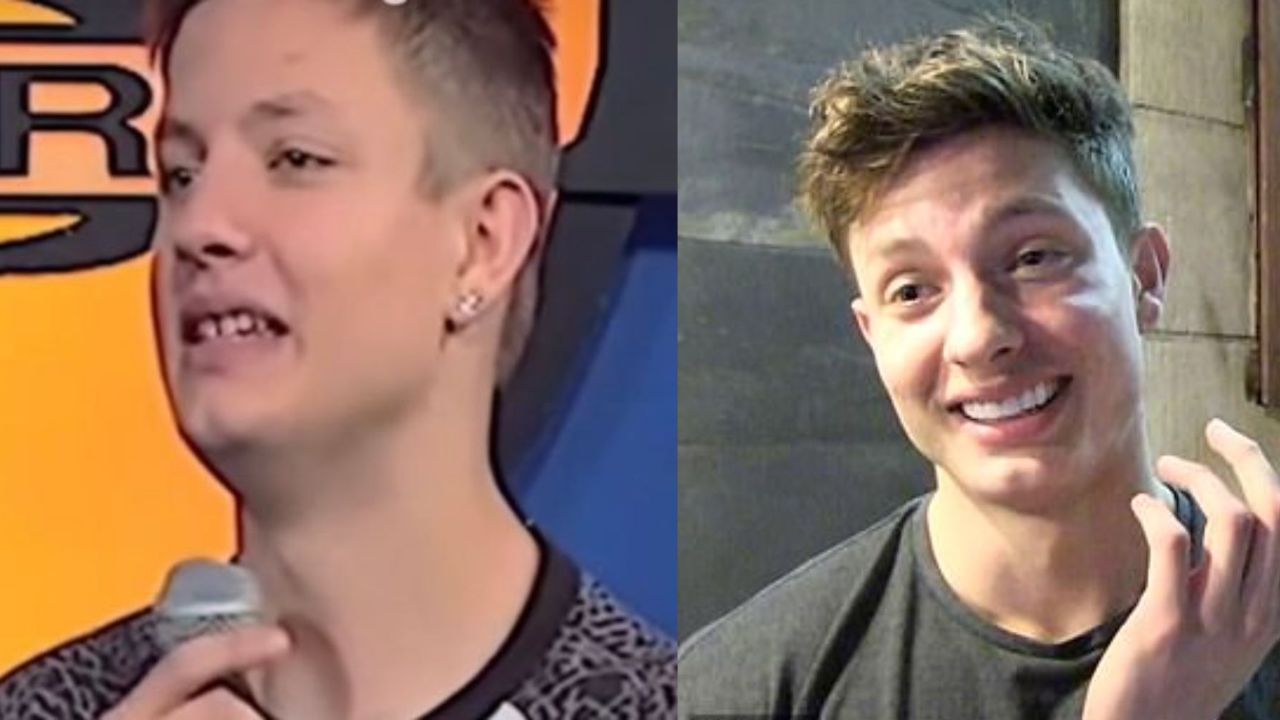 Matt Rife Before Fixing His Teeth: The Wild ‘n Out Star’s Glow Up Examined! blurred-reality.com