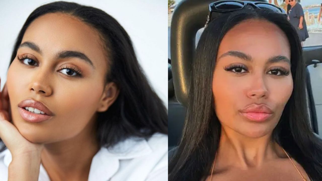Ella Thomas before and after plastic surgery. blurred-reality.com