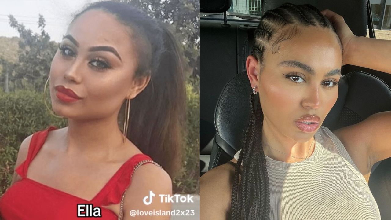 Love Island: Ella Before and After Pictures; Plastic Surgery, Cheek Filler & 2023 Update! blurred-reality.com