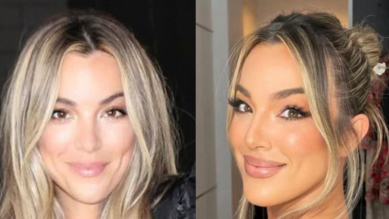 Alex Hall’s Plastic Surgery: Her Face Looks Completely Unnatural! blurred-reality.com