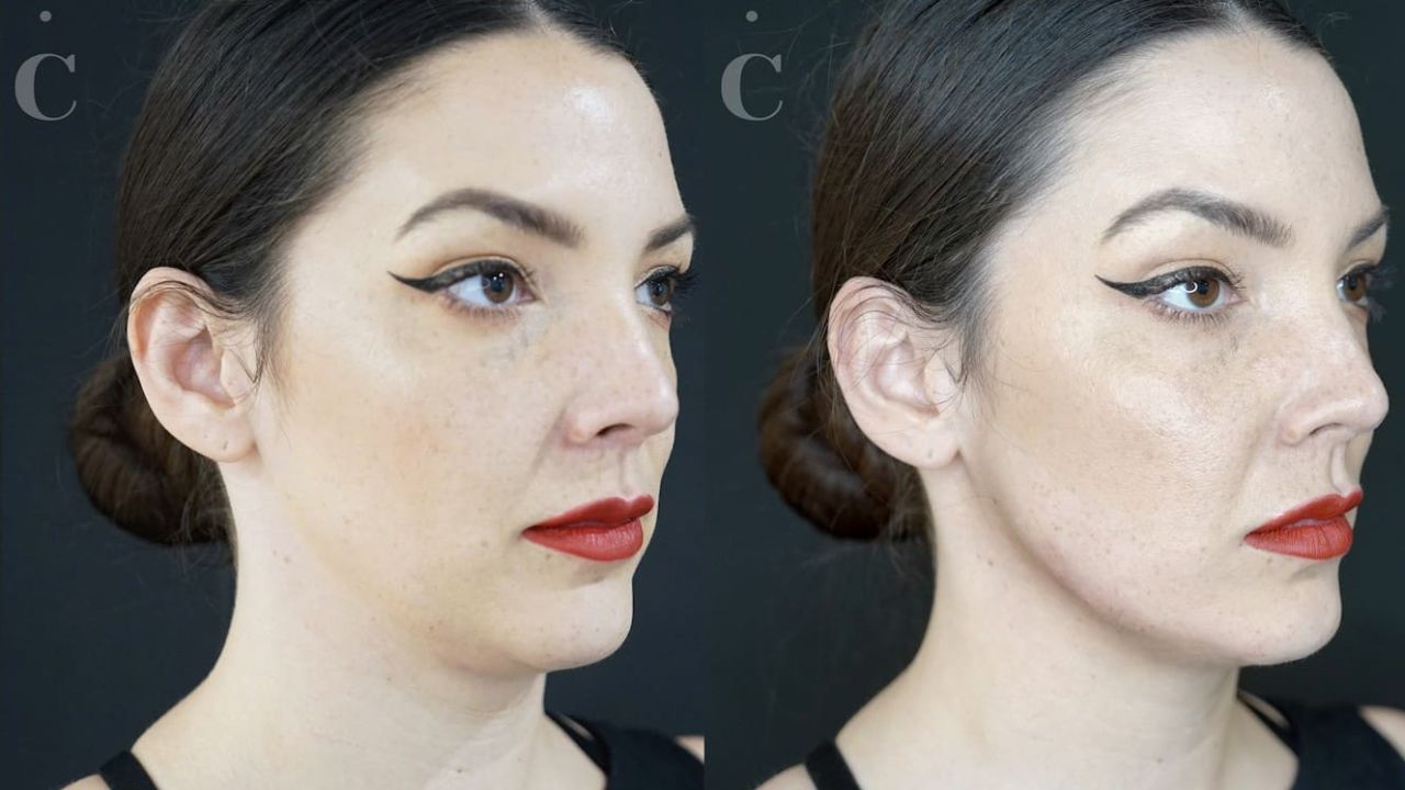 You can transform your jawline through multiple surgery procedures. blurred-reality.com