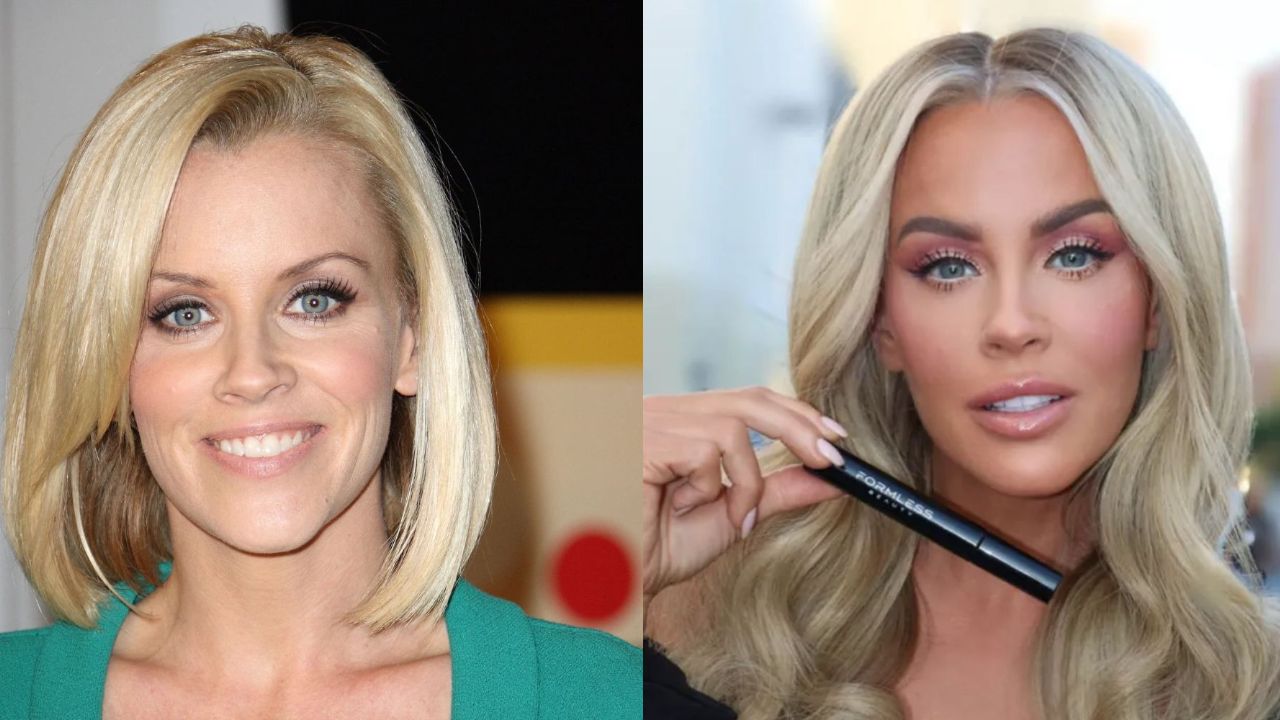 The Truth About Jenny McCarthy’s Plastic Surgery! blurred-reality.com