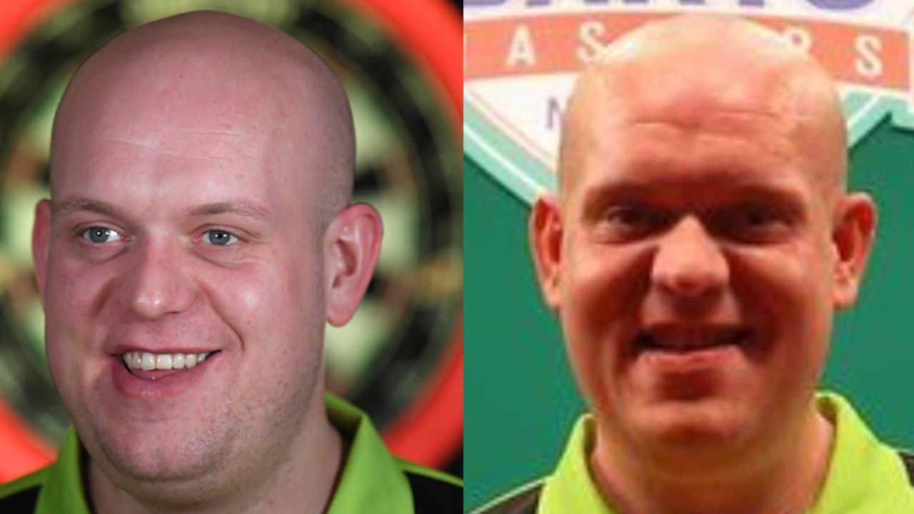 Michael Van Gerwen Teeth Operation: Braces & Dental Work (Operation); Before and After Pictures Examined! blurred-reality.com