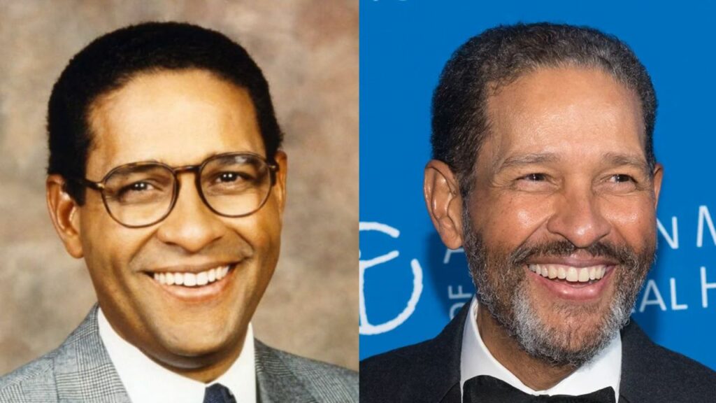 Did Bryant Gumbel Undergo Face Surgery? blurred-reality.com
