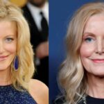 Anna Gunn’s Alleged Nose Job Doesn’t Suit Her at All blurred-reality.com