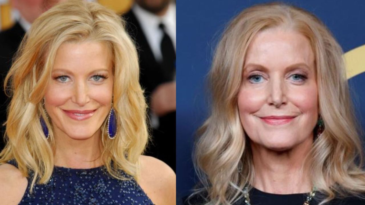 Anna Gunn’s New Nose Doesn’t Suit Her at All