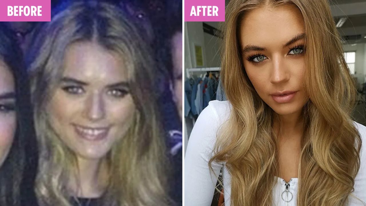 Arabella Chi before and after a nose job. blurred-reality.com