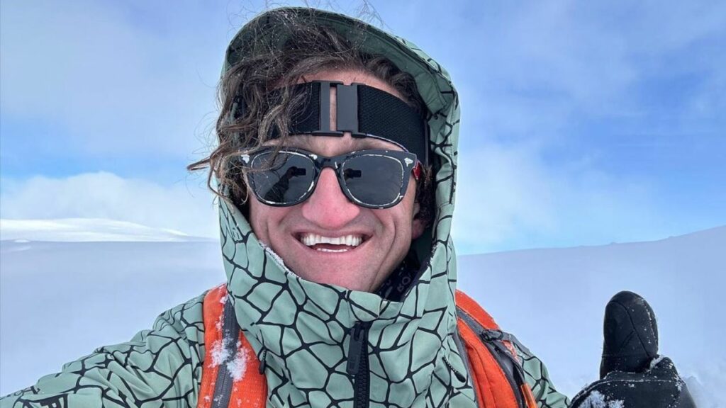 How Did Casey Neistat Fix His Teeth? blurred-reality.com