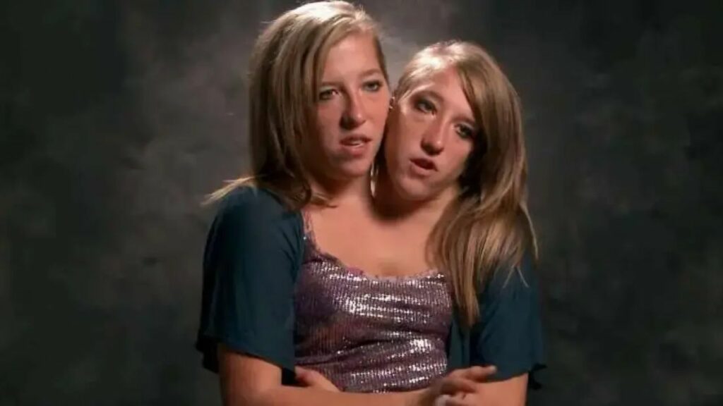 Conjoined Twins Abby and Brittany Hensel: Pregnant, Cause of Death, Sad News, Baby, 2024! blurred-reality.com
