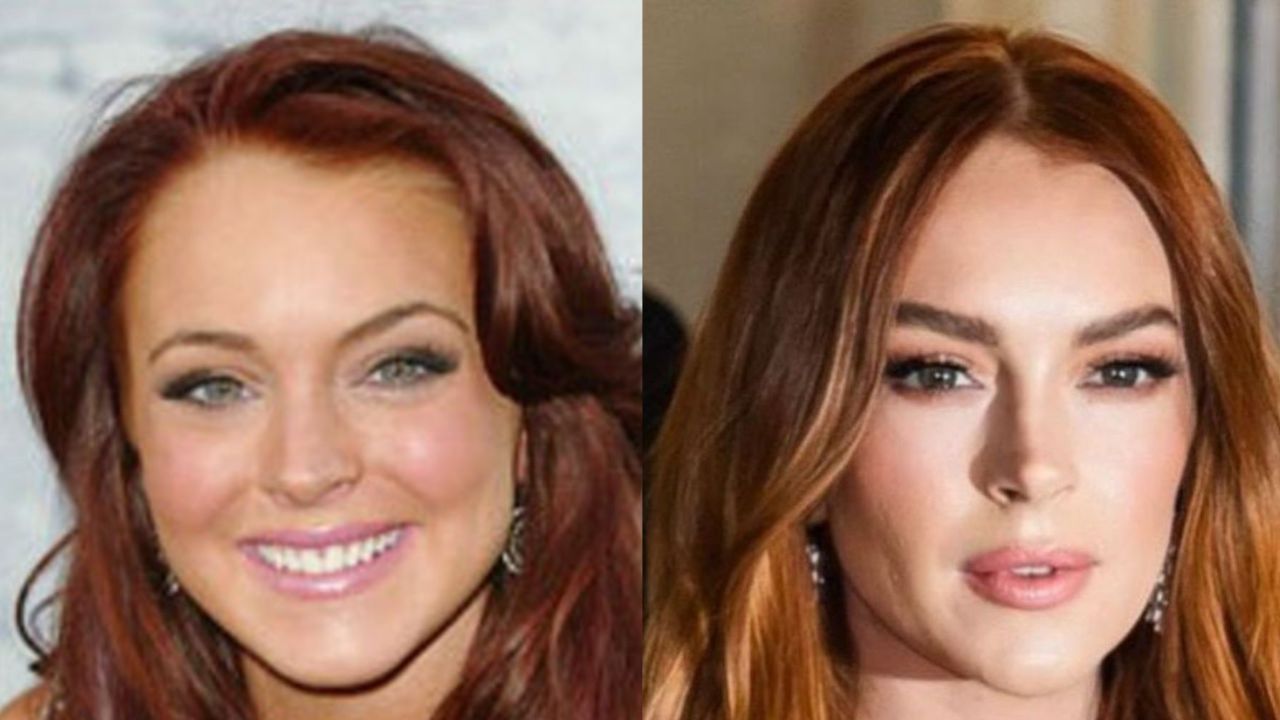 Lindsay Lohan’s Nose Does Not Look the Same Anymore blurred-reality.com