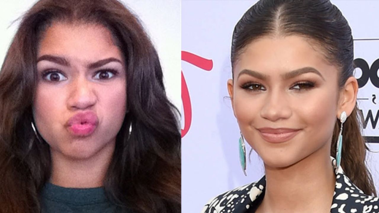 Zendaya before and after a nose job. blurred-reality.com