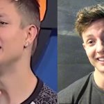 matt rife before fixing his teeth