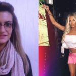 megan barton hanson plastic surgery