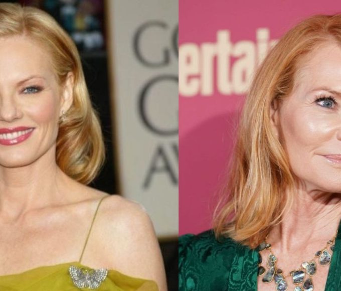 marg helgenberger plastic surgery 1